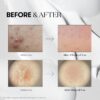 VT COSMETICS CICA Reedle Shot 300, Advanced Night Exosome, M...