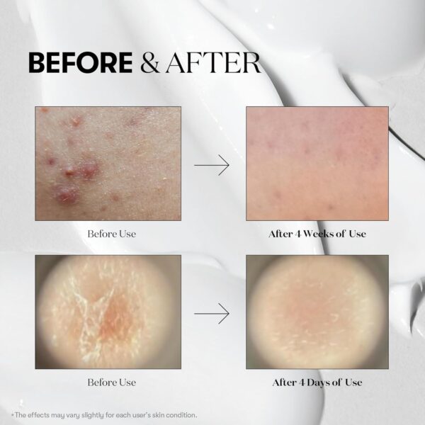 VT COSMETICS CICA Reedle Shot 300, Advanced Night Exosome, M...