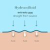 Rael Pimple Patches, Miracle XL Spot Control Cover - Hydroco...