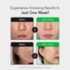 Centelsome 5X Soothing Toner 6.76 fl oz/200ml | Hydrating & ...