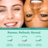 Patchology Under Eye Gel Patches – Natural Eye Masks for Puf...