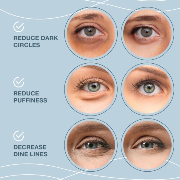 Under Eye Patches for Puffy Eyes and Dark Circles – 24k Gold...