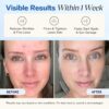 LilyAna Naturals Anti Aging Retinol Face Cream for Women – W...