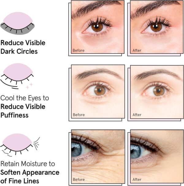 grace & stella Award Winning Under Eye Mask - Travel Essenti...
