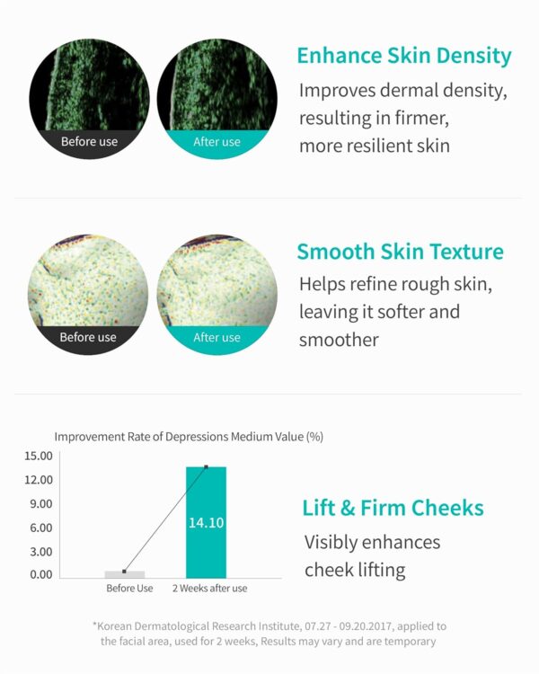 REJURAN® Turnover Ampoule, c-PDRN® – Original Salmon DNA PDR...