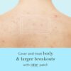 Rael Pimple Patches, Miracle XL Spot Control Cover - Hydroco...