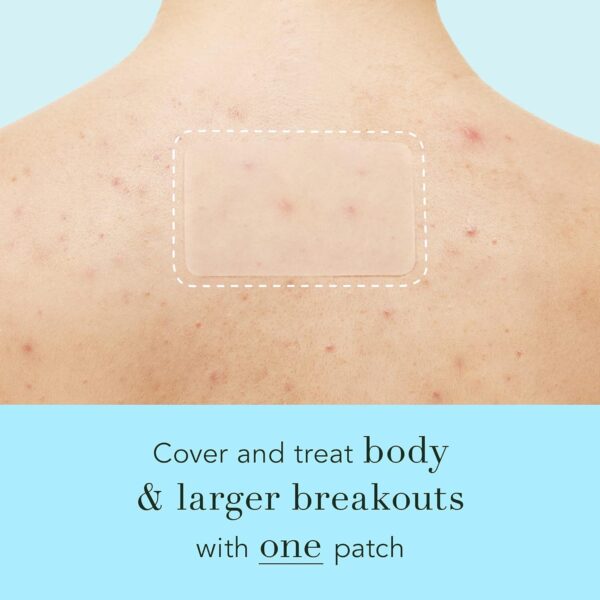 Rael Pimple Patches, Miracle XL Spot Control Cover - Hydroco...