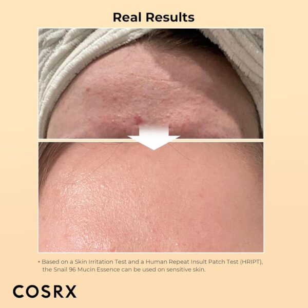 COSRX Snail Mucin 96% Power Repairing Essence 3.38 fl.oz 100...