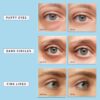 Enaskin Naturals Under Eye Patches for Dark Circles: 30 Pair...