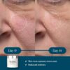 ELEMIS Dynamic Resurfacing Facial Pads, Gentle Textured Trea...