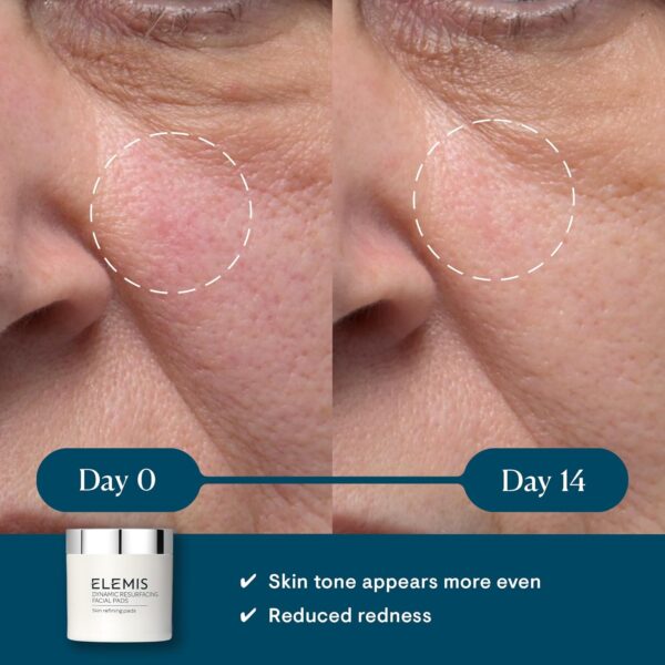 ELEMIS Dynamic Resurfacing Facial Pads, Gentle Textured Trea...