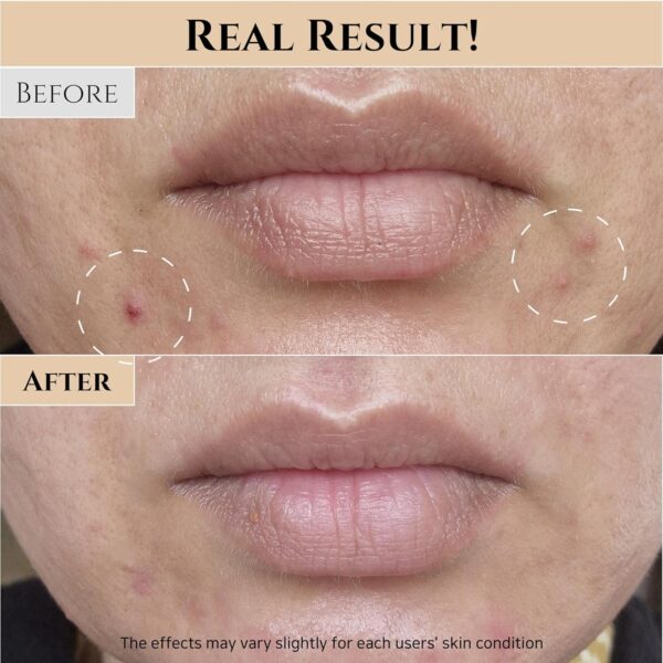 Beauty of Joseon Glow Replenishing Rice Facial Sebum Toner f...
