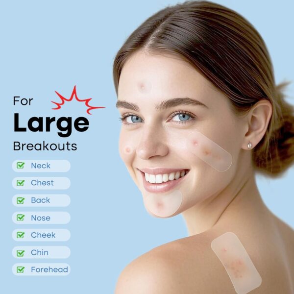 Large Pimple Patches for Face 331 Patches-7 Size,306 Round &...