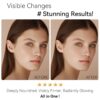 Retinol Face Moisturizer with Collagen & Hyaluronic Acid - I...