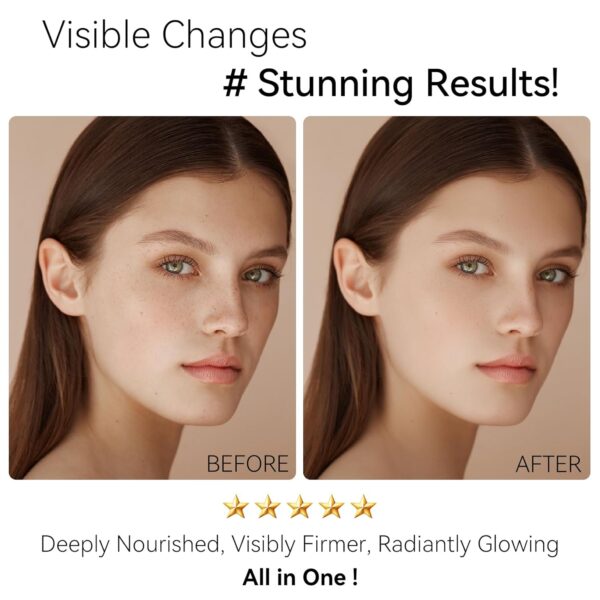 Retinol Face Moisturizer with Collagen & Hyaluronic Acid - I...