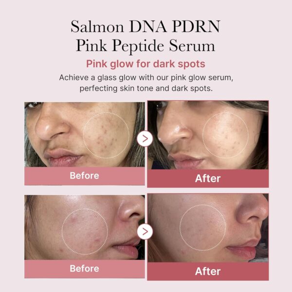 medicube Salmon DNA PDRN Pink Peptide Serum, Pink glow serum...