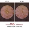 Peel Shot Glow White Rice Peeling Ampoule, Soft Exfoliating ...