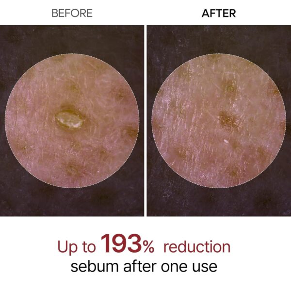 Peel Shot Glow White Rice Peeling Ampoule, Soft Exfoliating ...