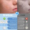 Large Pimple Patches for Face 331 Patches-7 Size,306 Round &...