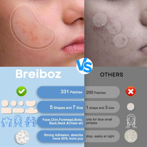 Large Pimple Patches for Face 331 Patches-7 Size,306 Round &...