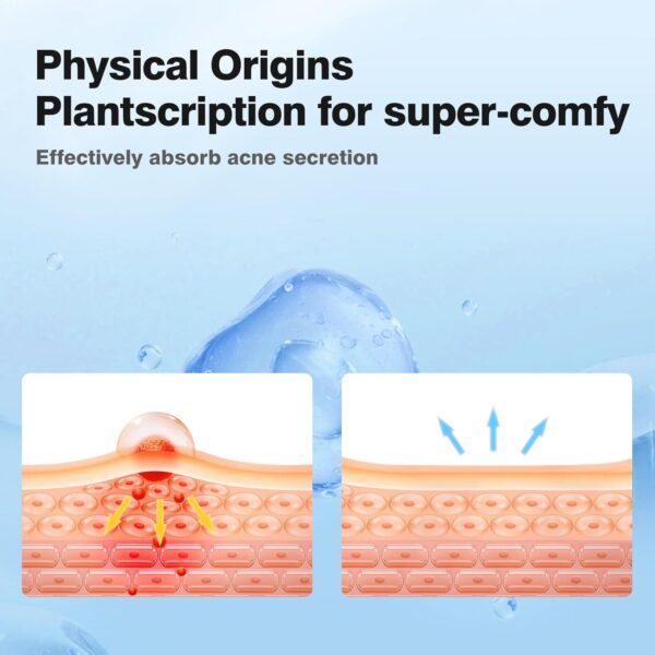 Pimple Patches for Face, Hydrocolloid Acne Patches, Cute Sta...