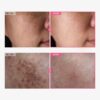 Arbutin 7% + Tranexamic Acid 4% Cream, 70,000ppm Arbutin, 40...