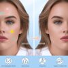 Pimple Patches for Face, Hydrocolloid Acne Patches, Cute Sta...