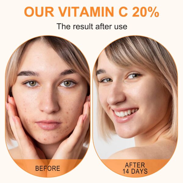 Premium 20% Vitamin C Serum For Face with Hyaluronic Acid, R...