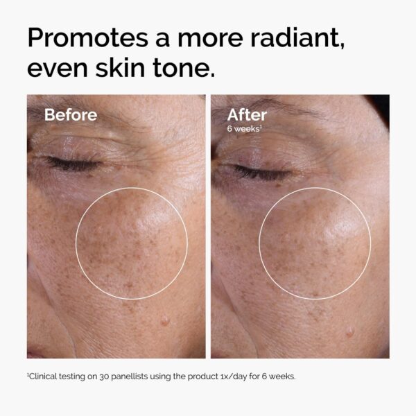 The Ordinary Glycolic Acid 7% Exfoliating Toner, Brightening...