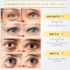 24K Gold Under Eye Patches - 60 Pack for Puffy Eyes, Dark Ci...