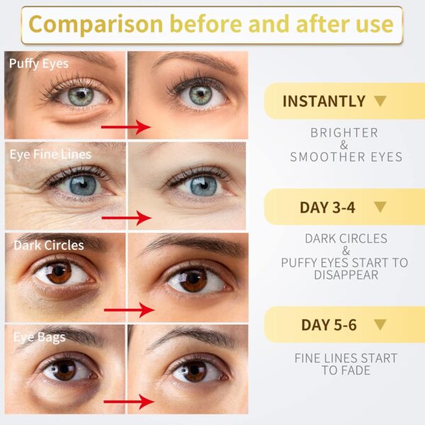 24K Gold Under Eye Patches - 60 Pack for Puffy Eyes, Dark Ci...
