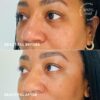 TULA Skin Care Eye Balm Rose Glow - Dark Circle Treatment, I...