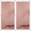 Oganacell DERX Cleanser - Walnut Cleanser for Clogged Pores,...