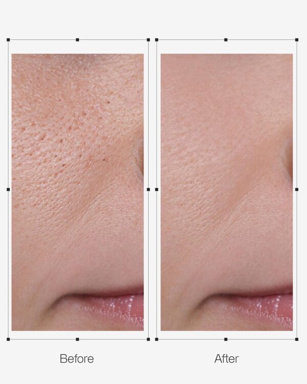 Oganacell DERX Cleanser - Walnut Cleanser for Clogged Pores,...