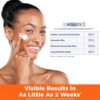 Palmer's Skin Success Anti-Dark Spot Nighttime Fade Cream wi...