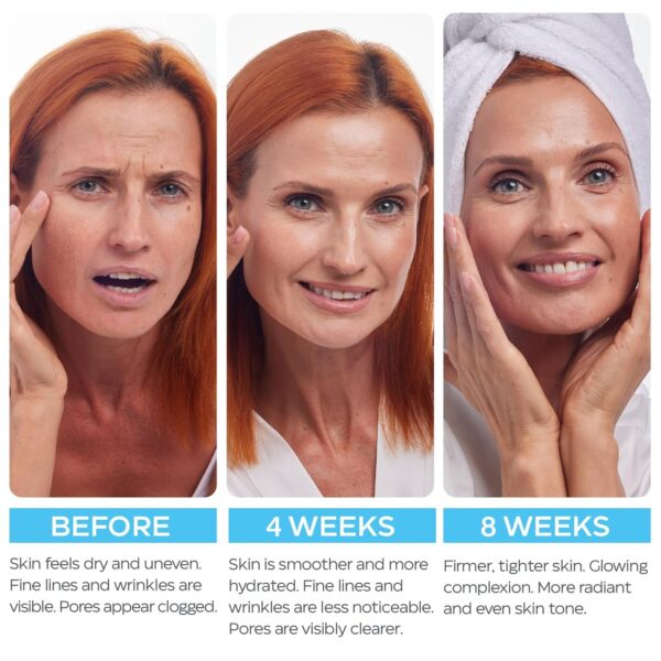 Retinol Cream for Face with Hyaluronic Acid, Anti Aging Wrin...