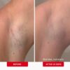 First Aid Beauty - Ingrown Hair Pads with BHA + AHA - Afters...