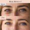 Beauty of Joseon Revive Eye Serum with Retinal Niacinamide C...