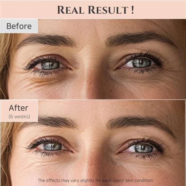 Beauty of Joseon Revive Eye Serum with Retinal Niacinamide C...