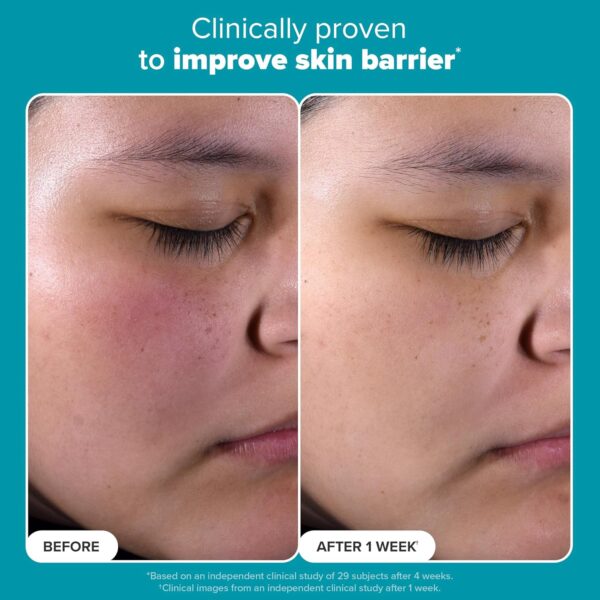 Paula's Choice SKIN PERFECTING 2% BHA Liquid Salicylic Acid ...