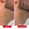 First Aid Beauty - Ingrown Hair Pads with BHA + AHA - Afters...